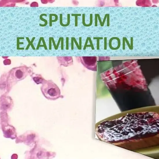 SPUTUM R/M (Routine Microscopy) Test